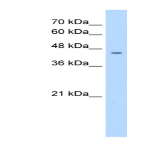 anti-Nuclear Receptor Subfamily 1, Group I, Member 3 (NR1I3) (C-Term) antibody