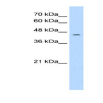 Anti-nuclear_receptor_subfamily_1_group_i_member_3_nr1i3_c-term_antibody_original_arp33674-qc11748-wb-image-01