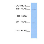 anti-Nuclear Receptor Subfamily 1, Group D, Member 2 (NR1D2) (N-Term) antibody