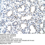 anti-THO Complex 1 (THOC1) (C-Term) antibody