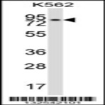 anti-REC8 Homolog (Yeast) (REC8) (AA 194-222), (Center) antibody