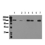 anti-Cadherin 1, Type 1, E-Cadherin (Epithelial) (CDH1) antibody