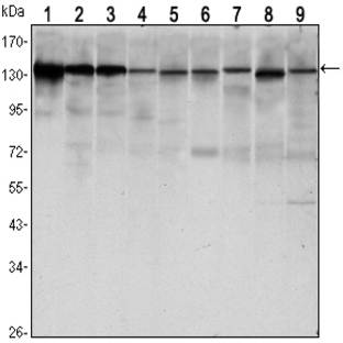anti-Cadherin 1, Type 1, E-Cadherin (Epithelial) (CDH1) antibody