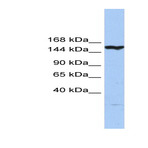 Anti-casp8_associated_protein_2_casp8ap2_n-term_antibody_original_arp50555-qc20269-wb-image-01