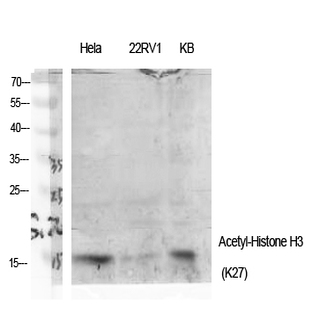 Histone H3 (Acetyl Lys27) Polyclonal Antibody