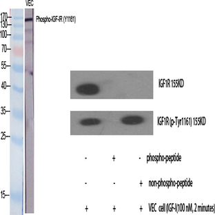 IGF-IR (phospho Tyr1161) Polyclonal Antibody