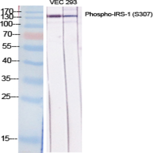 IRS-1 (phospho Ser307) Polyclonal Antibody