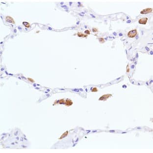 Rabbit Monoclonal Antibodies avatar