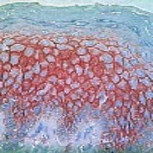 anti-CD44 (CD44) (Exon v3 avatar