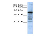 anti-Hephaestin (HEPH) (N-Term) antibody